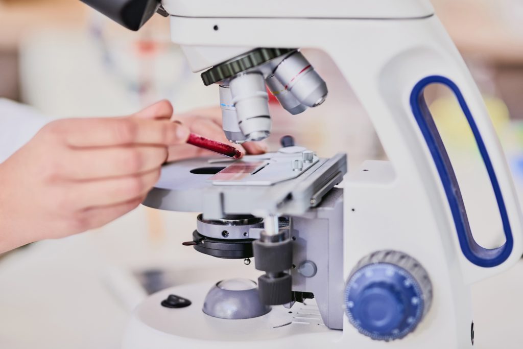 TST manteve a condenação de laboratório a indenizar a filha de um operador de produção que trabalhou exposto a substâncias químicas tóxicas.