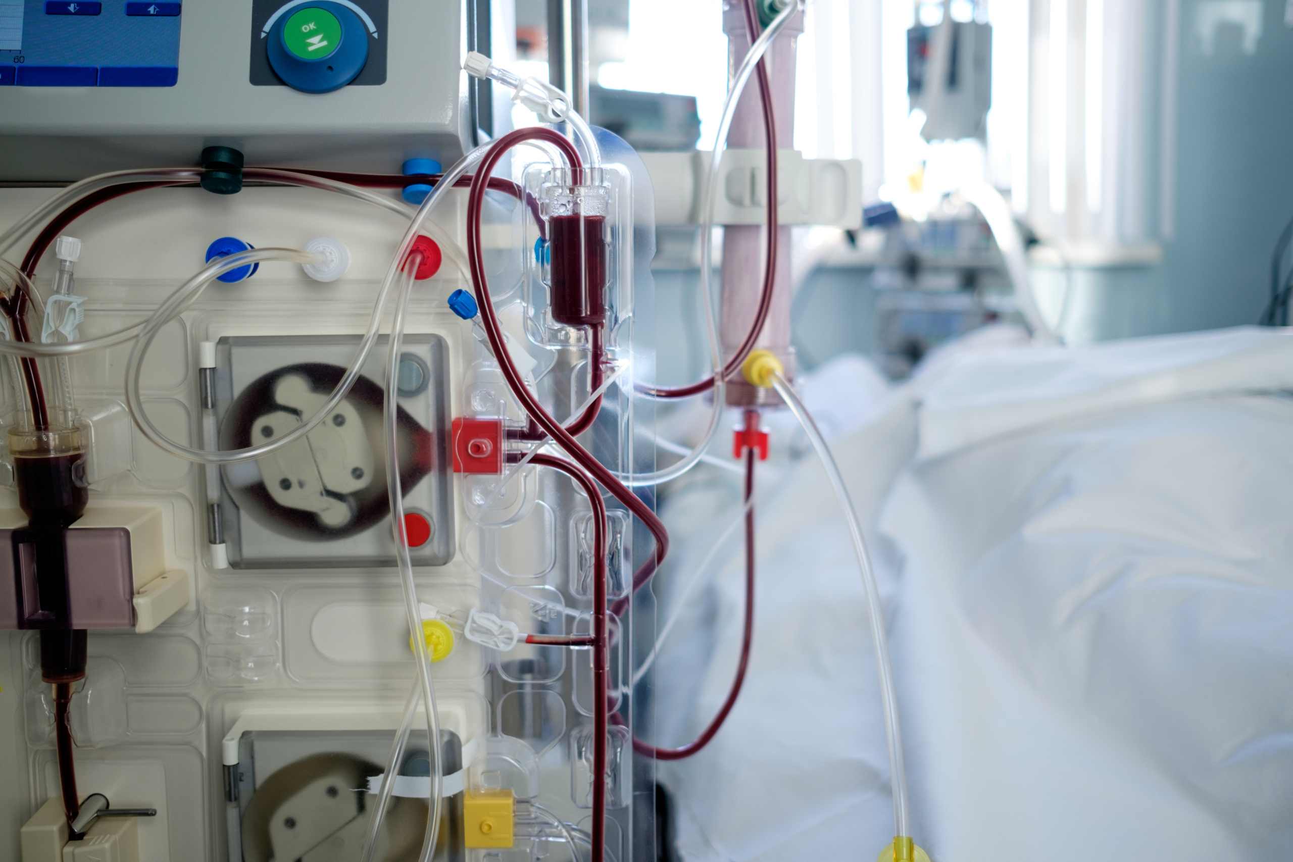 Juiz explicou que Estado não pode propor hemodiálise como alternativa a medicamento preventivo de crise renal