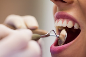 Dentista manuseia instrumento enquanto paciente mulher abre a boca