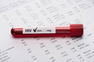 exame HIV positivo